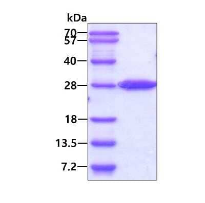 SDS-PAGE: Recombinant Human STARD5 His Protein [NBP2-22829]